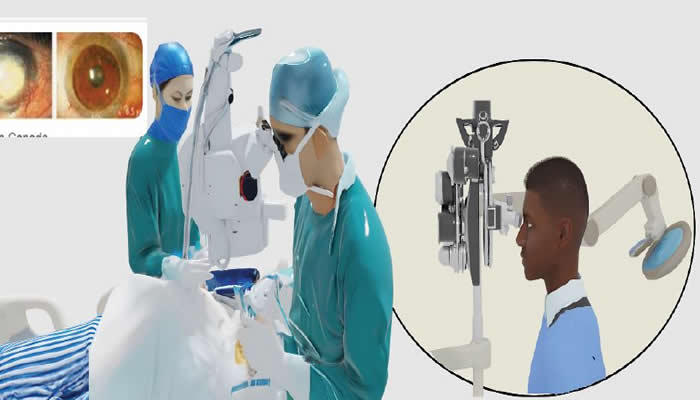Breakthrough for repairing corneas, restoring sight