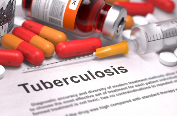 Tuberculosis not caused by spiritual forces, treatment free