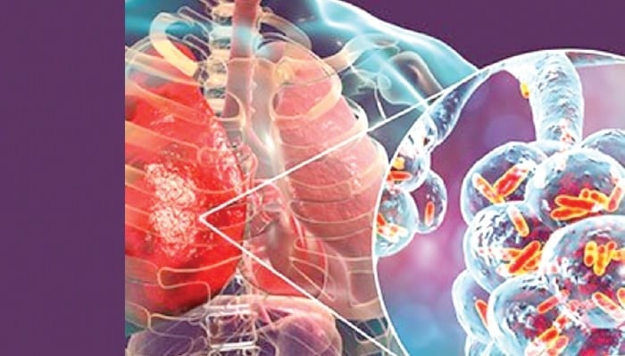 10 neglected killer diseases sending Nigerians to early grave