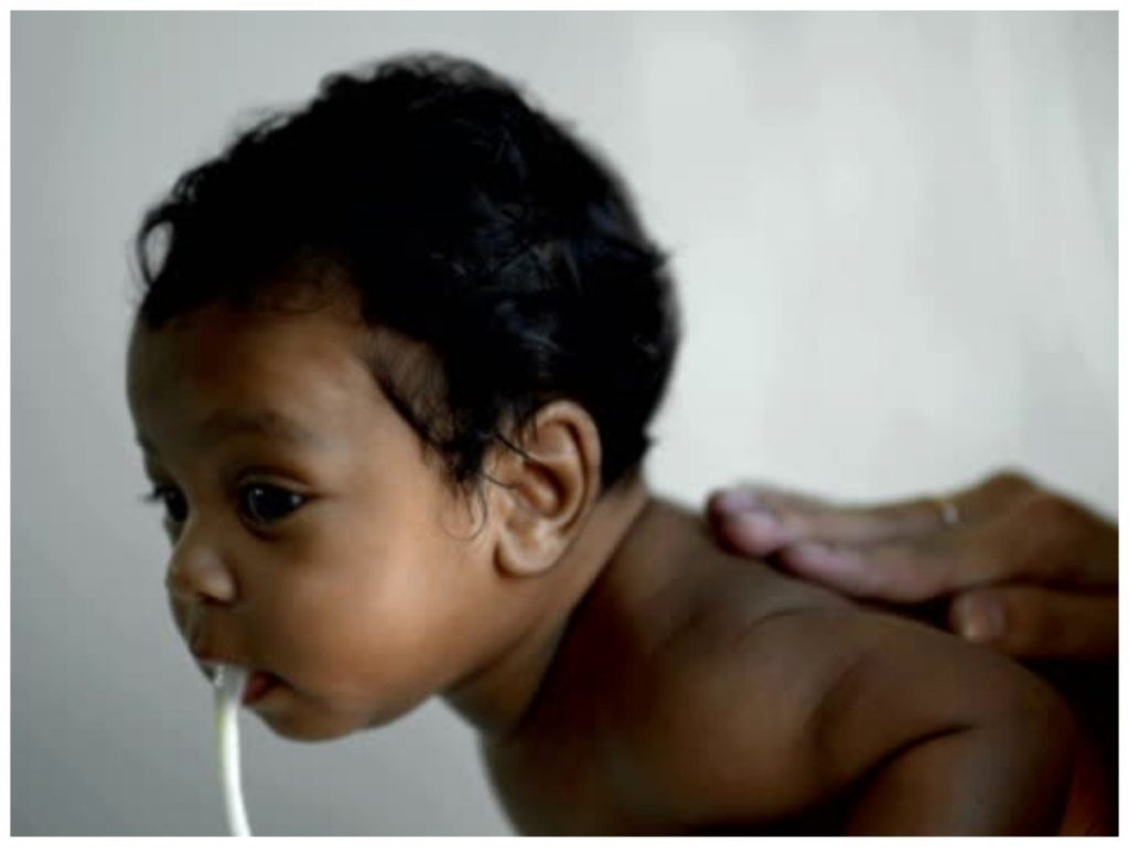 Babies vomiting after feeding may be sign of infection — Paediatricians