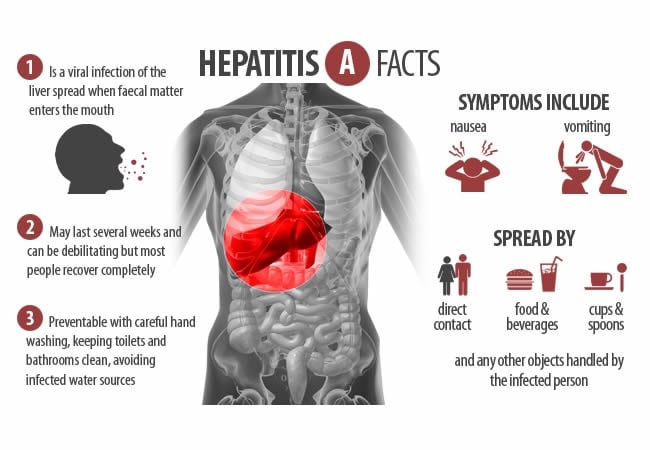 12,060 Nigerians live with Hepatitis B, C in 12 states – Report