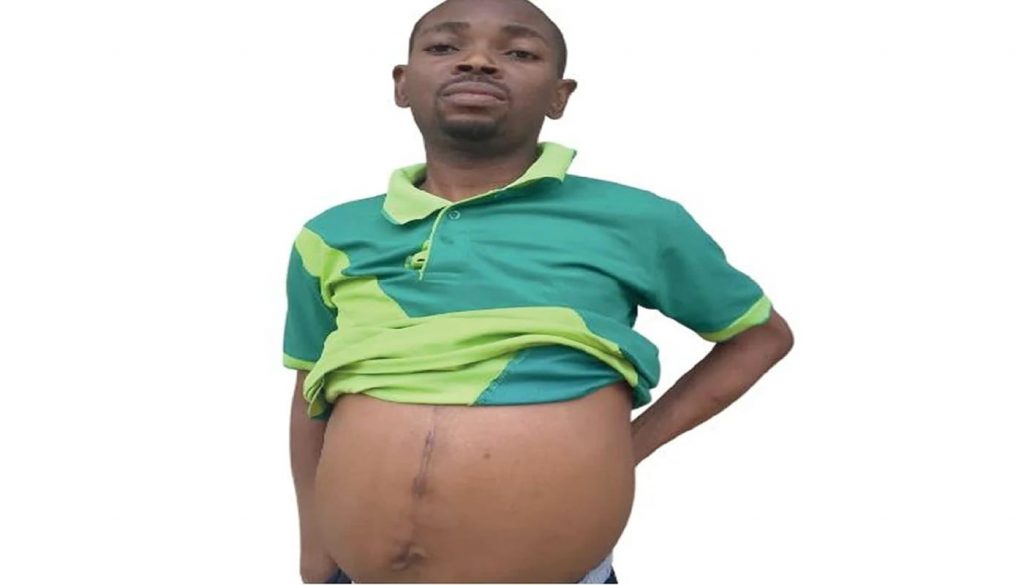 Patient fights for survival, demands justice after losing both kidneys