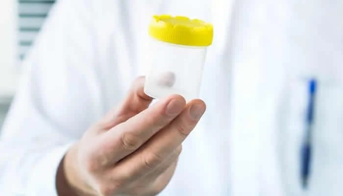 Nearly 200 children conceived from sperm donor with increased cancer risk