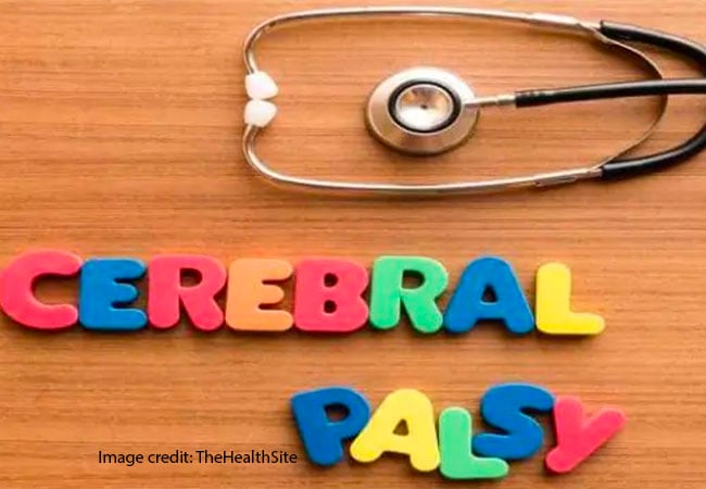 No traditional medicine can cure cerebral palsy, doctors tell parents