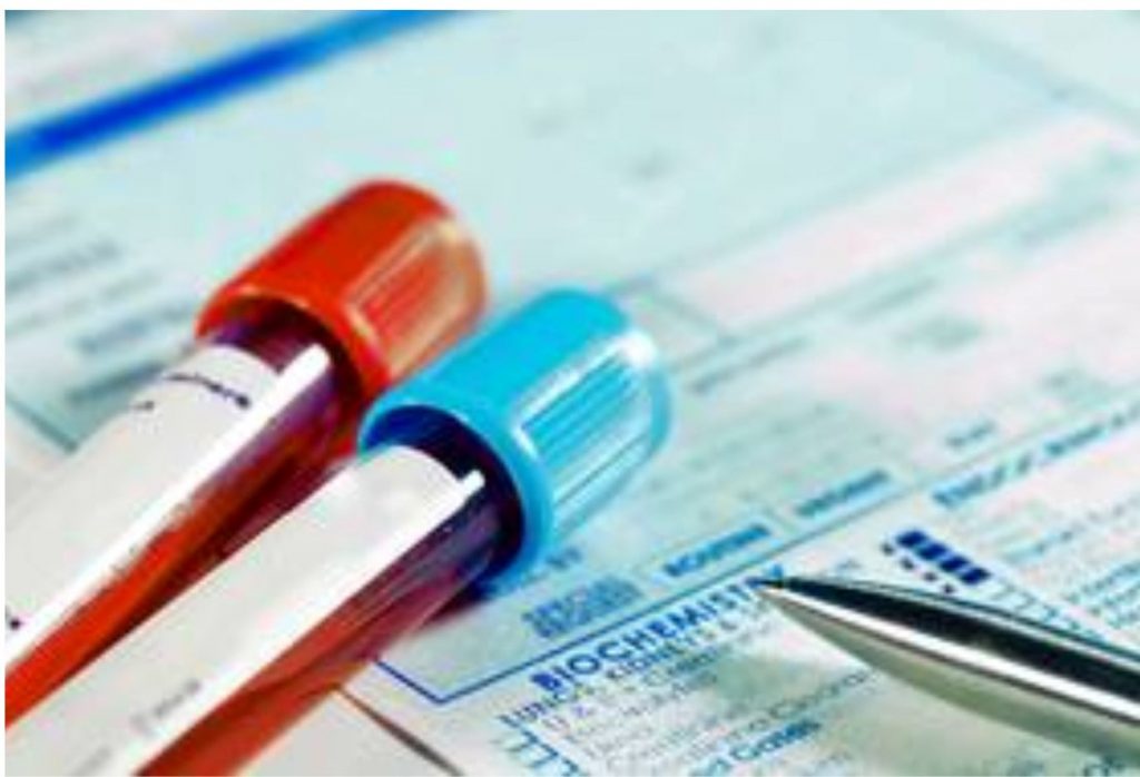 Four in five Africans lack access to basic diagnostics at primary health facilities —Report