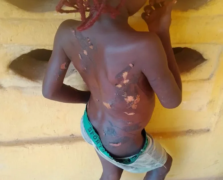 Mother burns seven -year-old daughter with hot knife over stolen meat