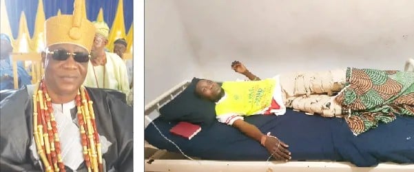Killer drink: Inside Ondo communities’ grief over 48 deaths