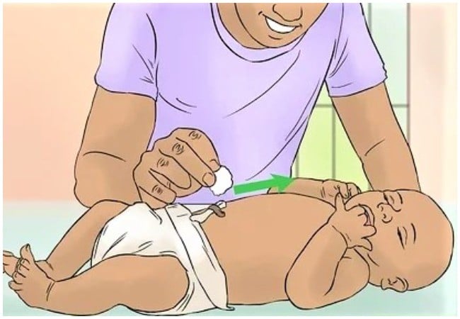 Don’t ignore delayed umbilical cord separation, paediatricians tell parents